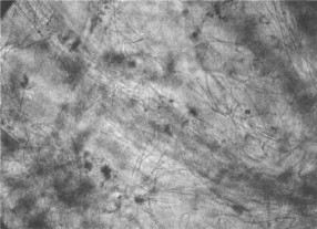 MBR汙泥膨（péng）脹怎麽處理？汙（wū）泥膨脹的處理方法(圖2)